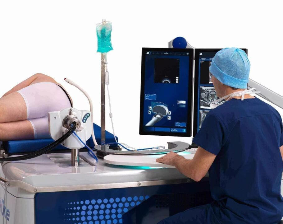 The ultrasound of the prostate